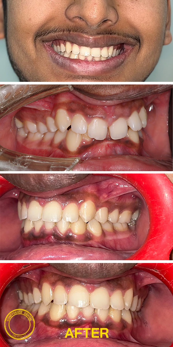 Confydentz dental case reports