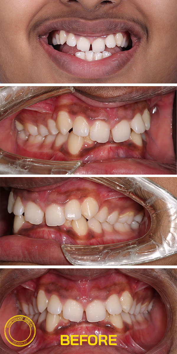 Confydentz dental case reports
